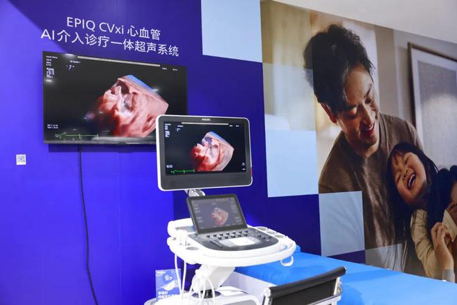 解码飞利浦2025CMEF：创新引领AI驱动医疗“全线”升级(图7)